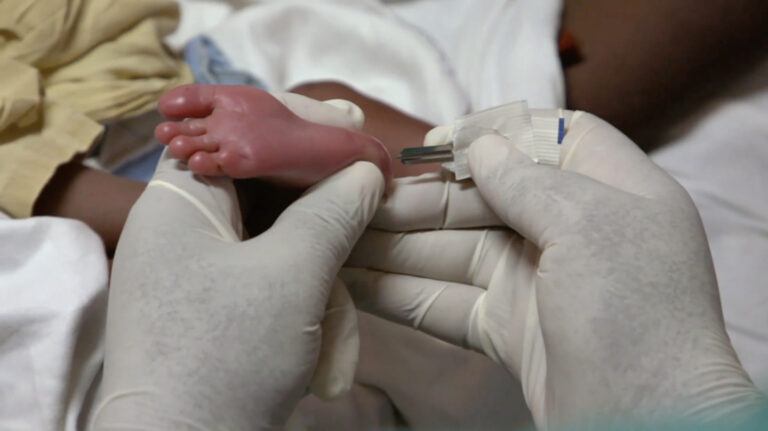 Le dépistage néonatal